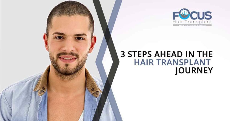 3 Steps Ahead in the Hair Transplant Journey