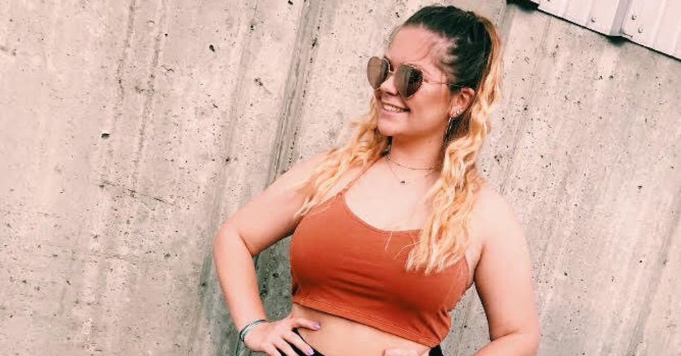 I'm 19 And I Have A Skin Graft