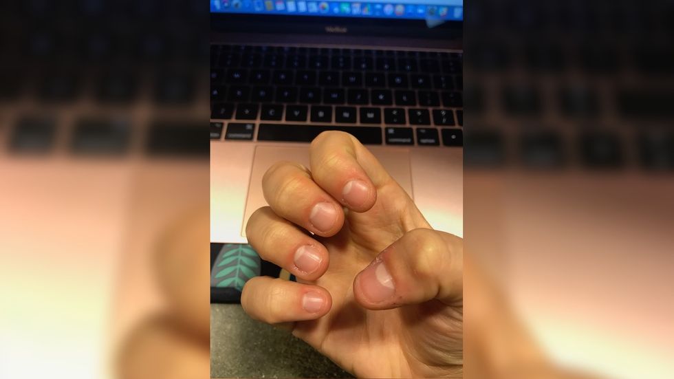 17 Times College Girls Start Biting Their Nails Again Even After Promising THIS Time They Would Stop
