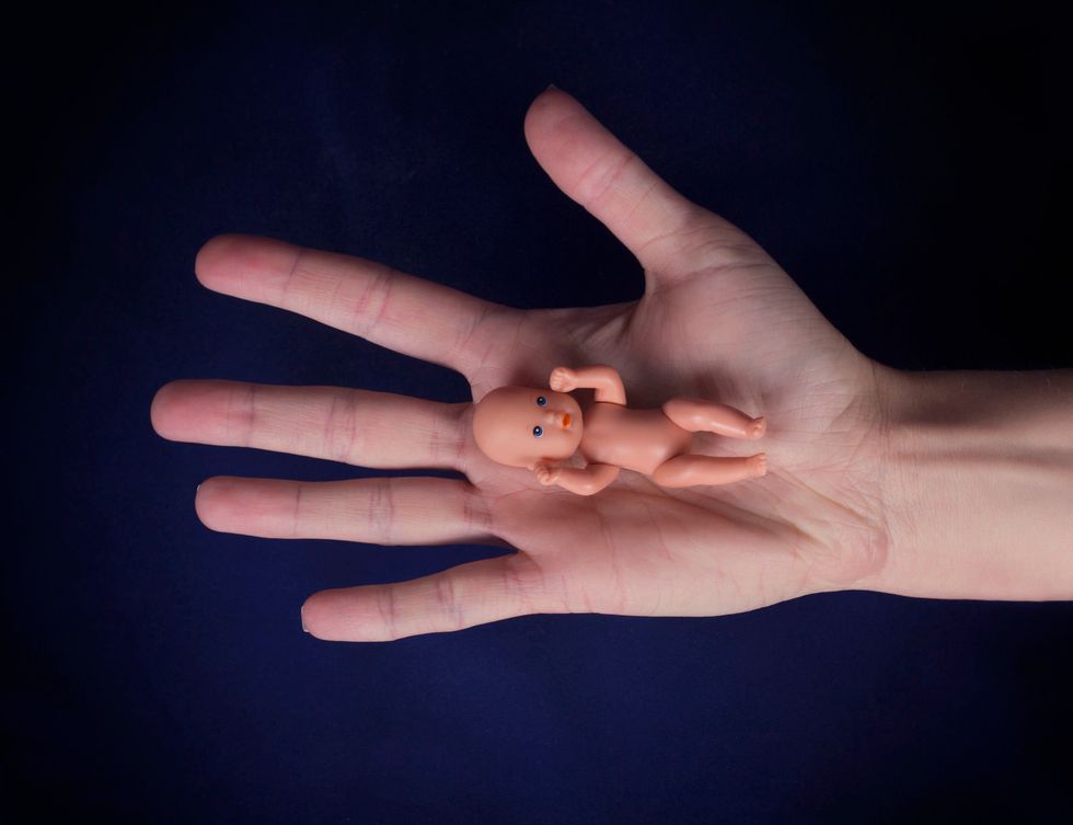 If You Call Yourself A Feminist But Don't Support Abortion, Excuse Me But What?