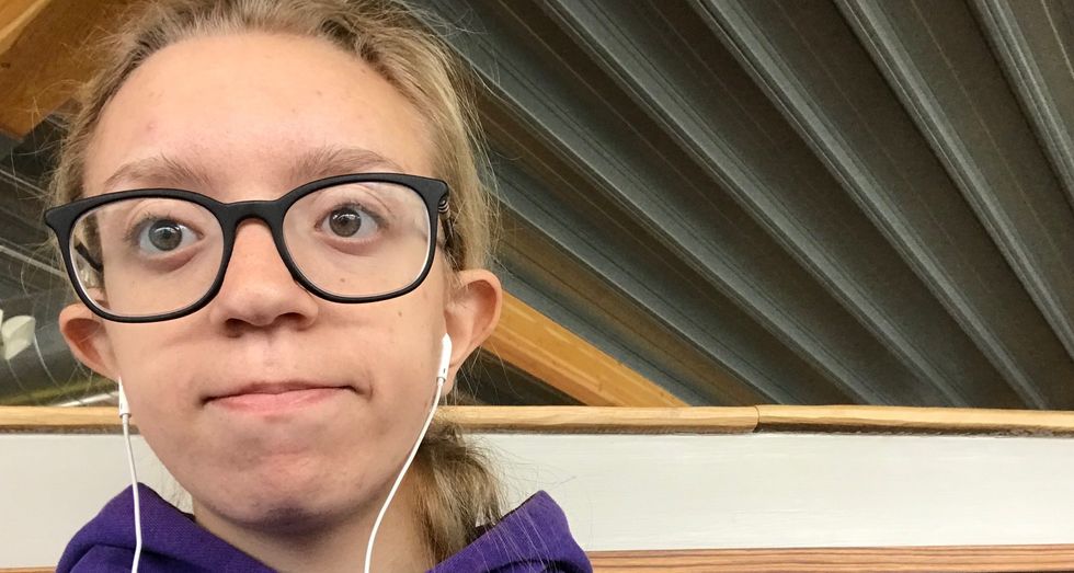 I Am 20 And I Have Acne, Acne Scars And Blackheads, And That's OK