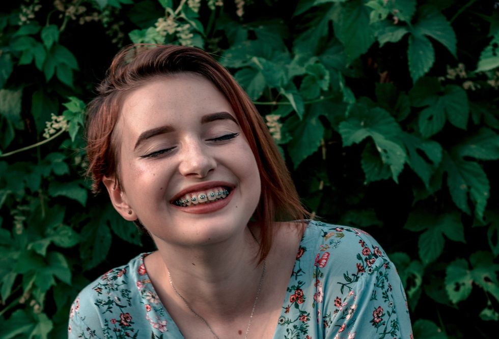 Yes, Having Braces In College Sucks, But I'll Be The One Smiling In The End