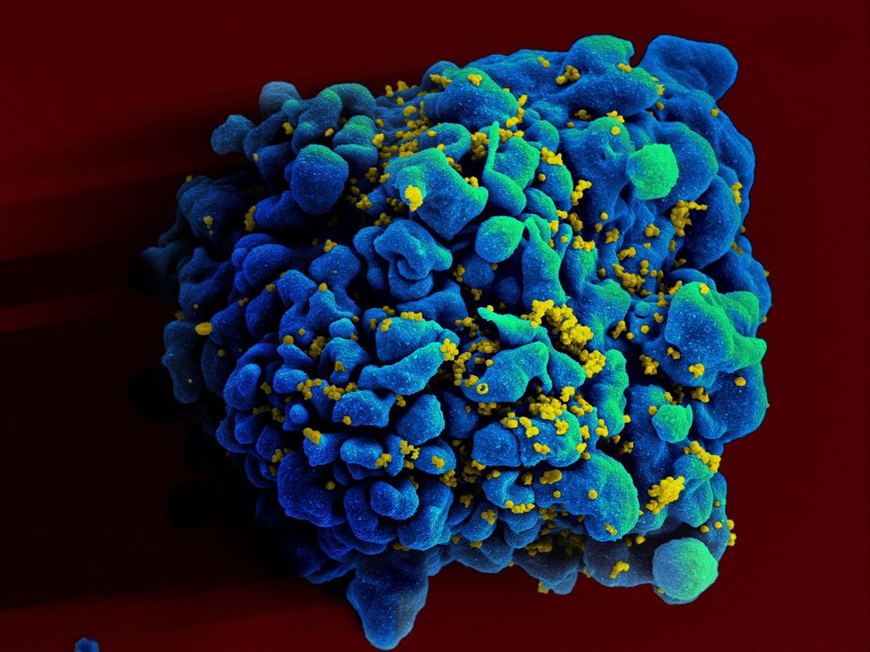 A Second Person Has Achieved Long-Term Remission Of The HIV Virus