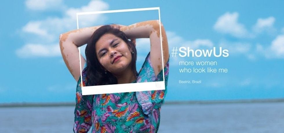 All About Dove's #ShowUs Campaign