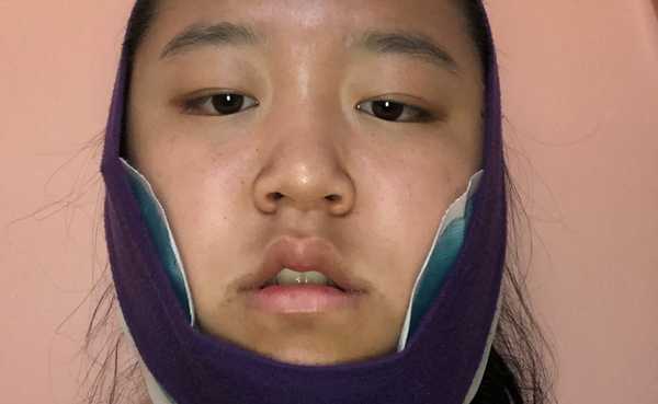 24 Things That I Did In The First 24 Hours After My Oral Surgery Instead Of Being Productive