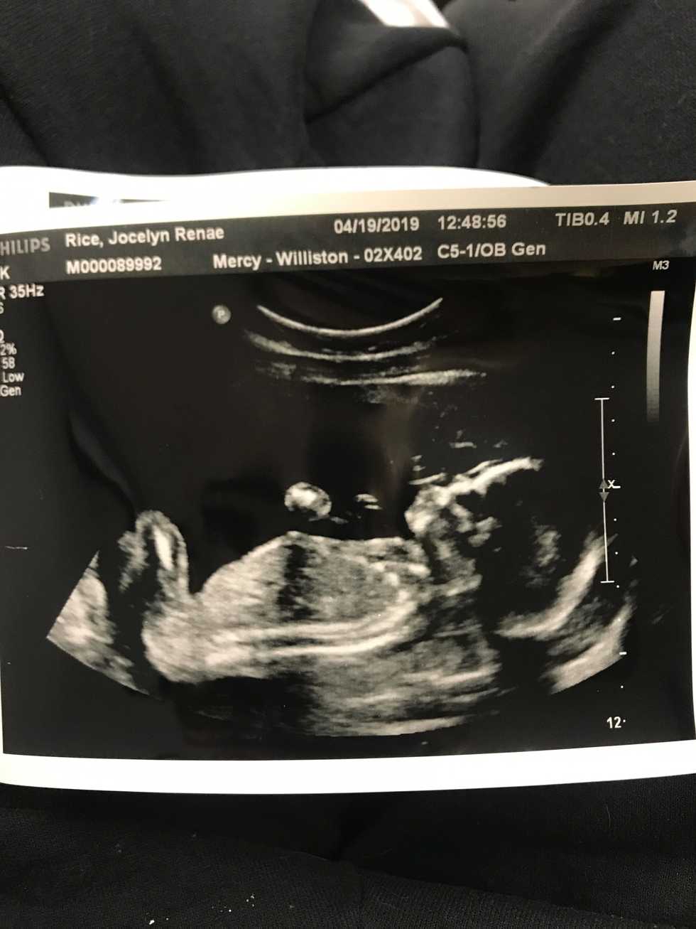 How I Can Be A Woman in 2019 Who Supports Pro-Life Decisions