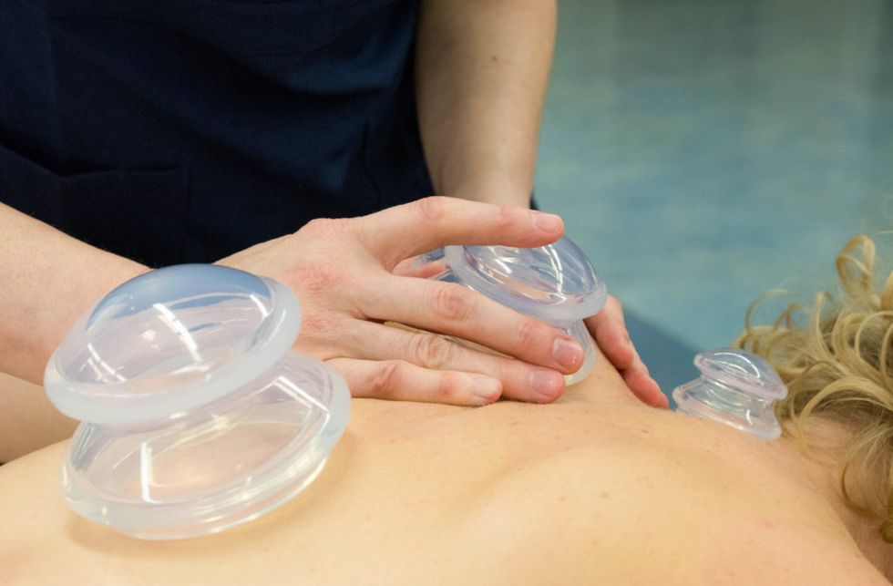 Top 6 Health Benefits of Cupping Massage