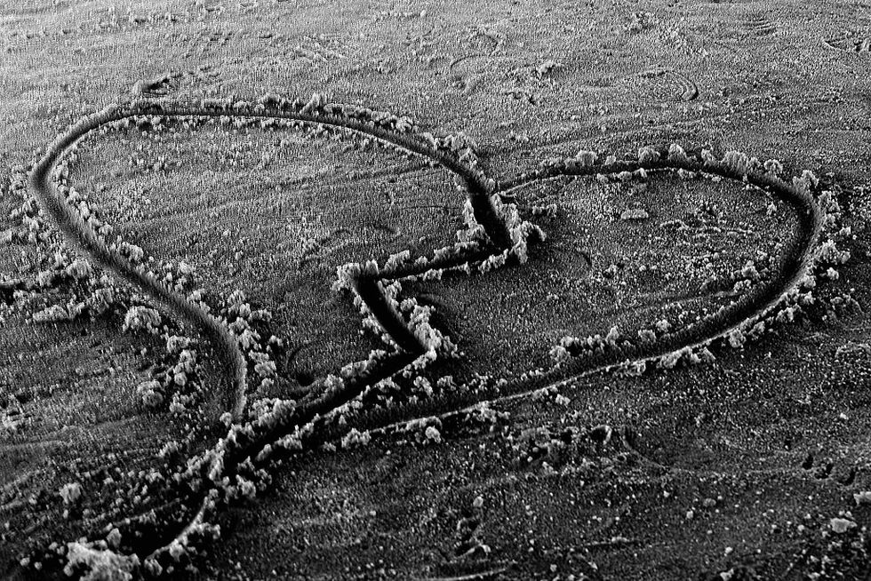 When Life Gives You The Finger!