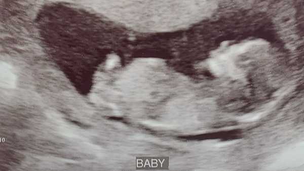 11 Promises To My Unborn Child, For A Time Of Global Darkness