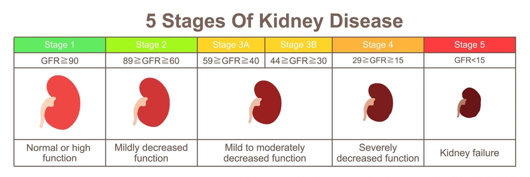 What are the Causes Of Chronic Kidney Diseases?