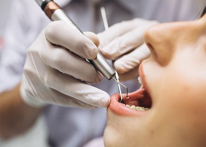 An overview of Root Canals and Implant Dentistry, Causes, Signs, Procedure, and Aftermath