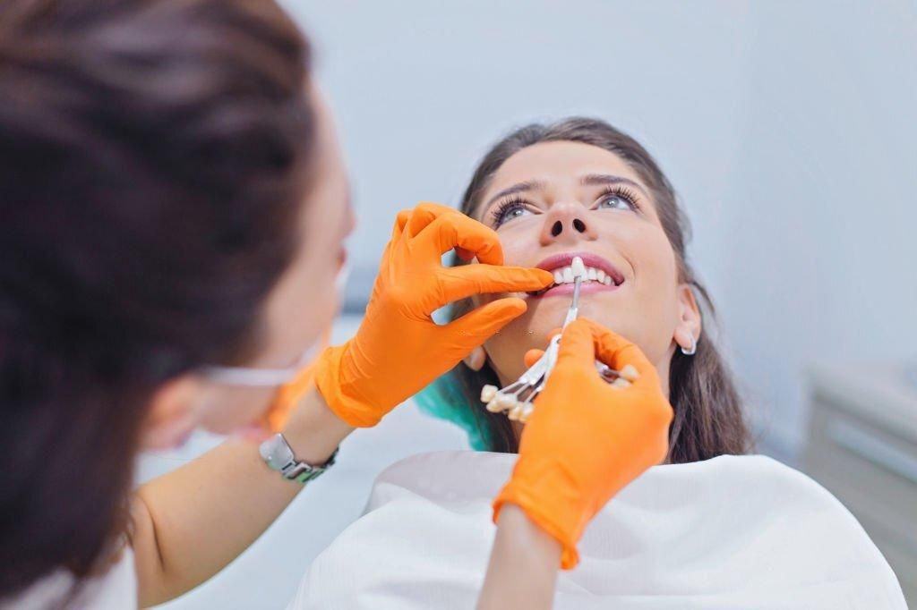What You Need to Know About CEREC Dental Crowns