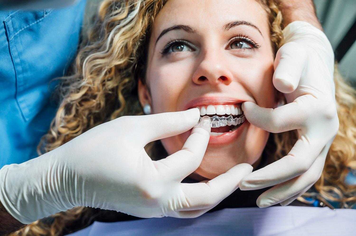 How Long Will It Take Your Teeth to Straighten with Invisalign?