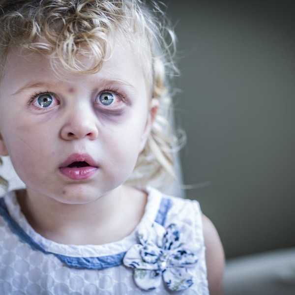 Reducing Child Abuse