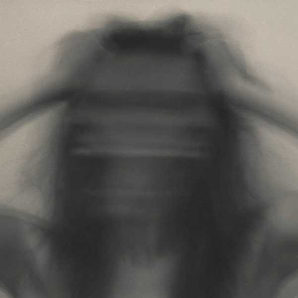 6 Things People Need to Understand About Anxiety
