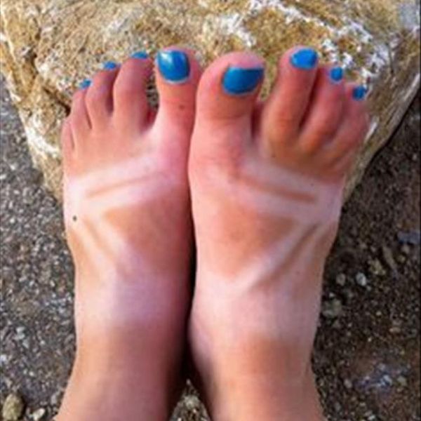 10 Things People With Fair Skin Understand