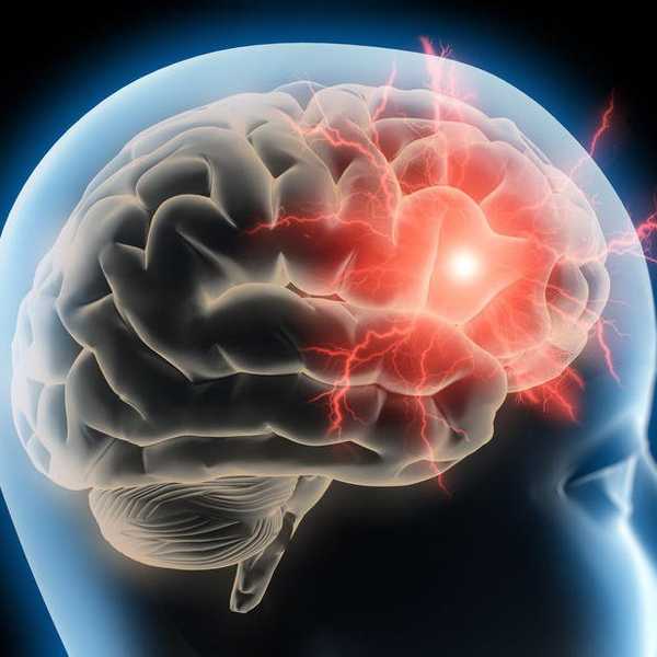 5 Things My Migraines Have Taught Me
