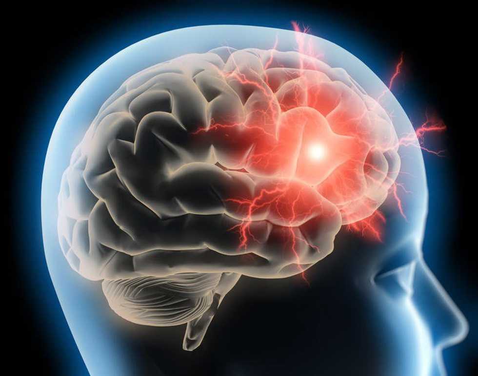 5 Things My Migraines Have Taught Me