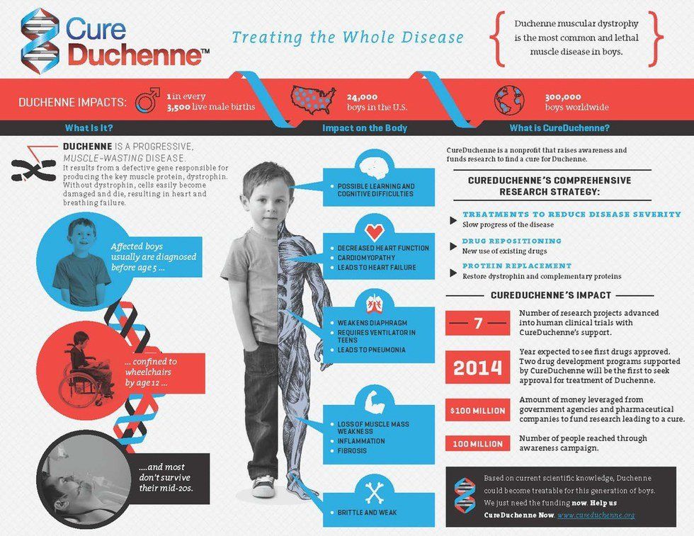 Duchenne Muscular Dystrophy