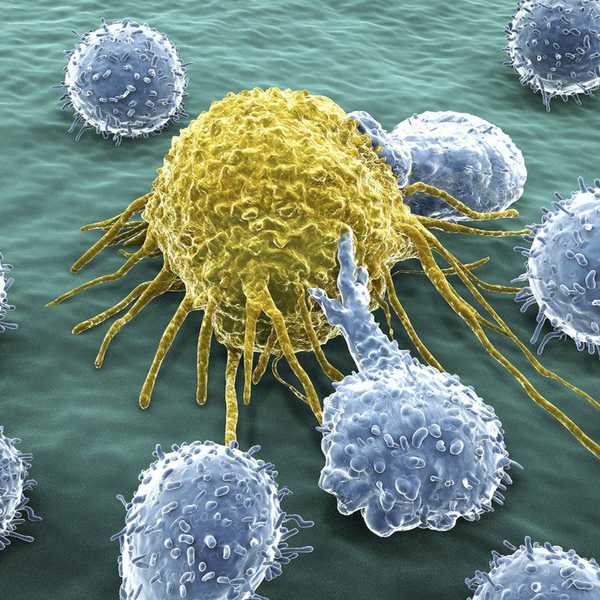 Cancer sucks.
