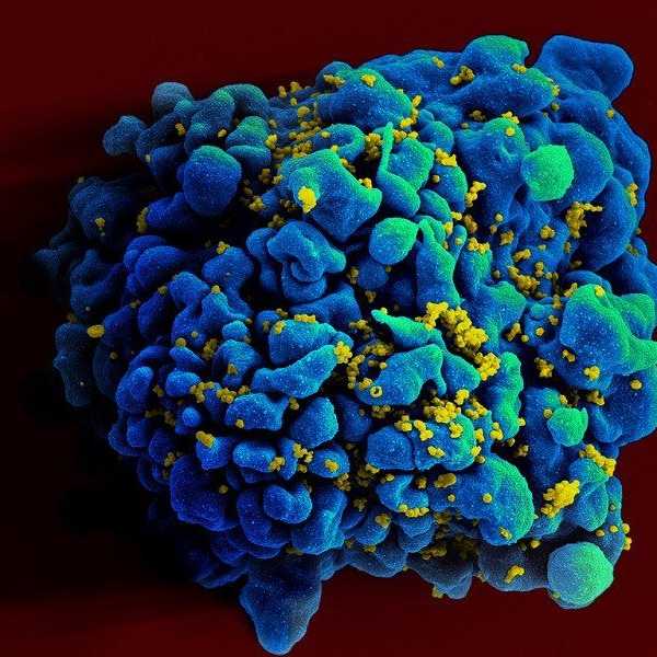 This Genetic Mutation Actually Leads To HIV Immunity