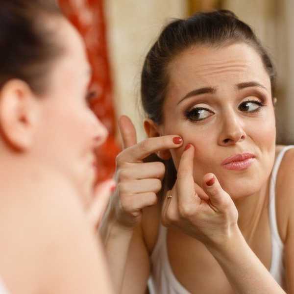 An Open Letter To Acne