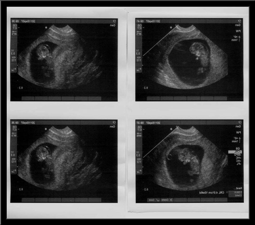 The Beautiful Life Inside Of You