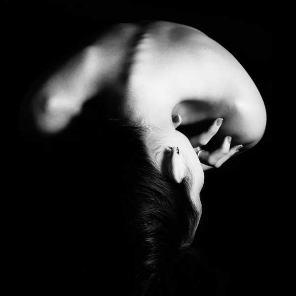 10 Things People With Scoliosis Understand