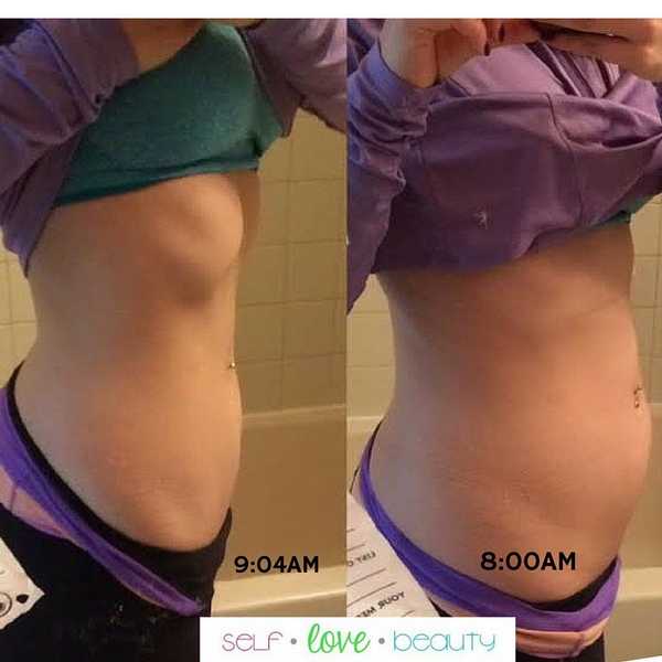 Making It Through The Bad Days Of Irritable Bowel Syndrome (IBS)