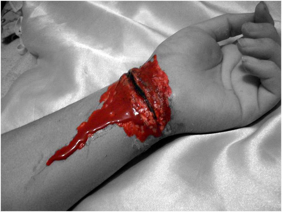 Psychological Abnormality And Grieving