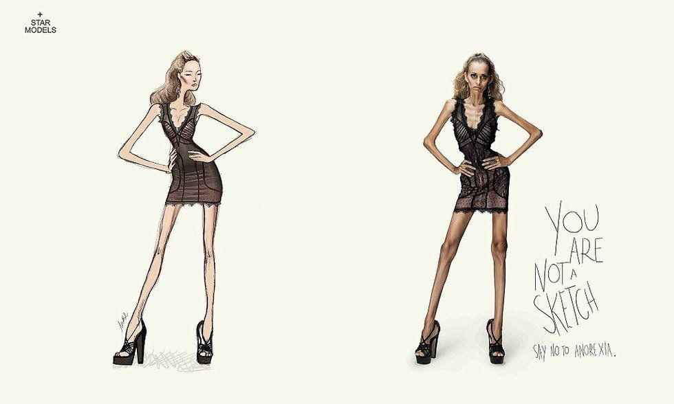 What People Don't Tell You About Recovery