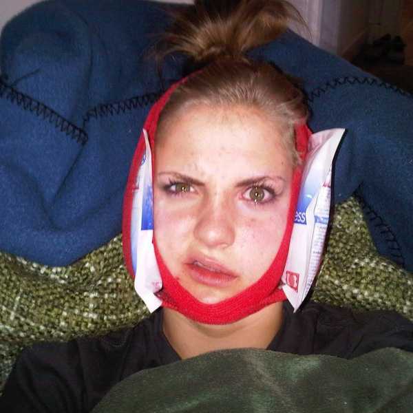 21 Foods To Eat After Wisdom Tooth Removal