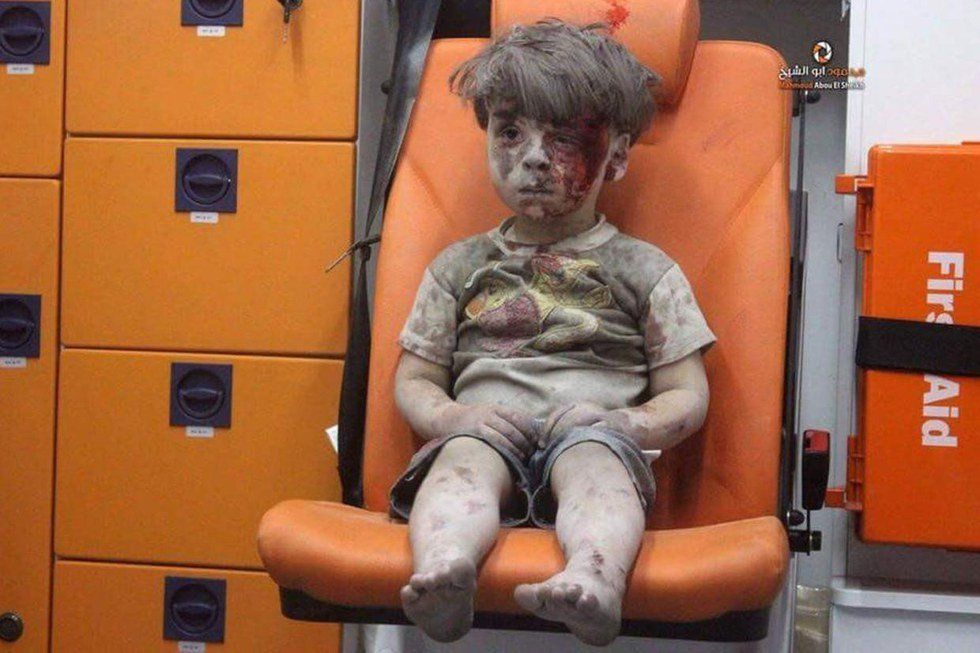 Do Not Forget About Omran Daqneesh