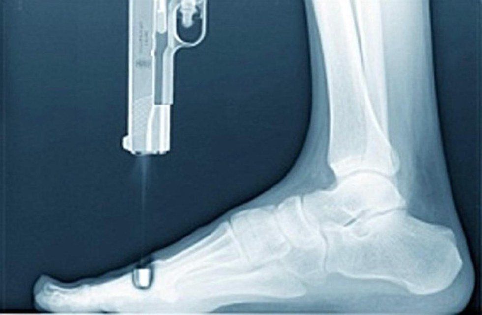 Shoot Yourself In The Foot