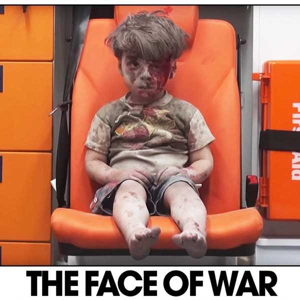 The Little Boy In The Ambulance: Why You Need To Understand What's Happening In Syria
