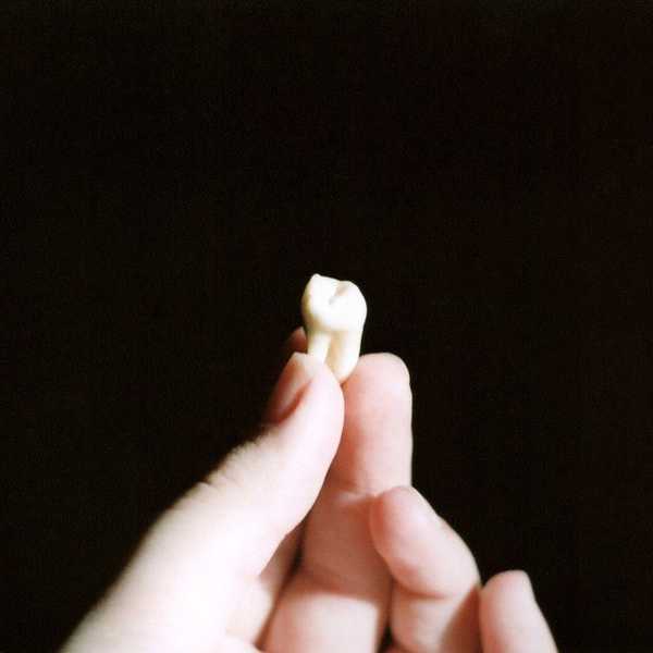 Dear Wisdom Teeth
