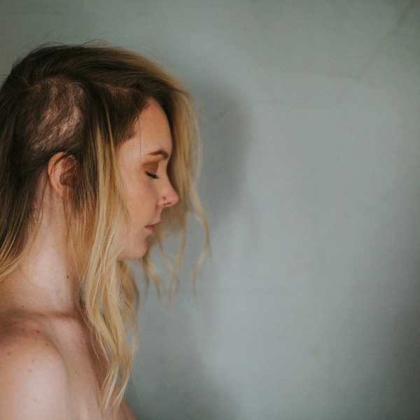 4 Things You Never Knew About Trichotillomania