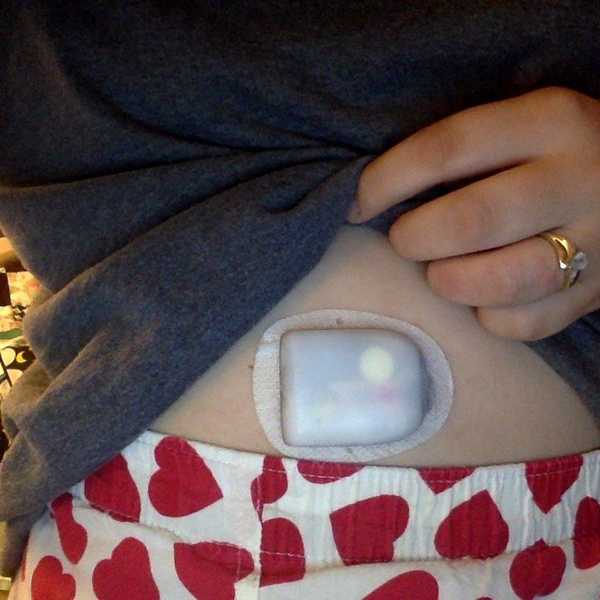 What It's Like To Be Diabetic