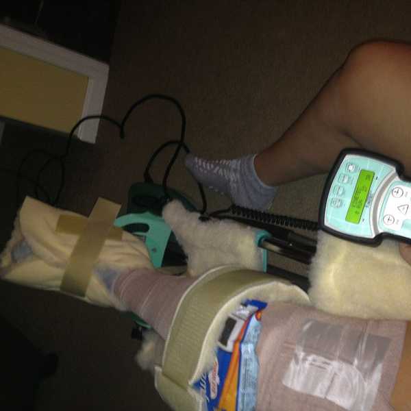 ACL Tears Should Never Stop Athletes