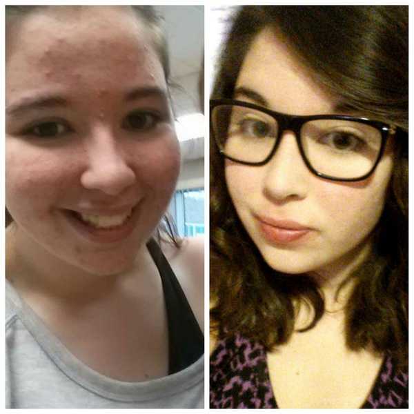 A Thing That Grows Bumps In The Night