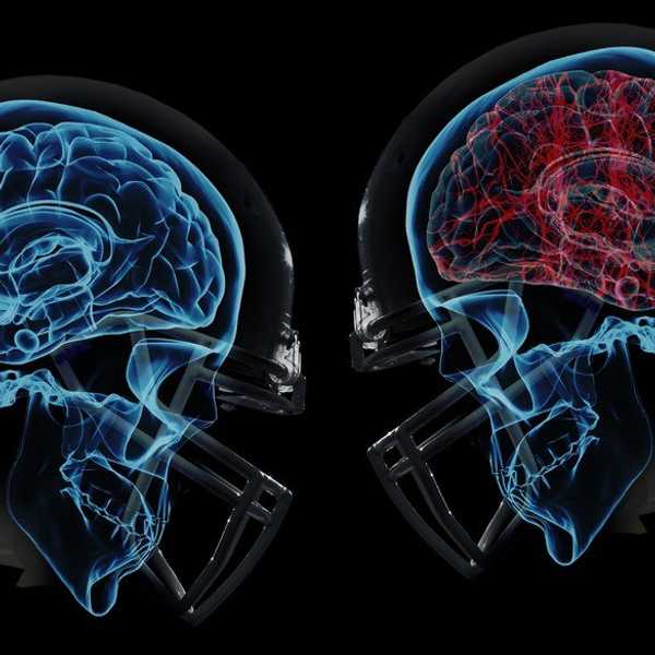 The Downfall Of Contact Sports