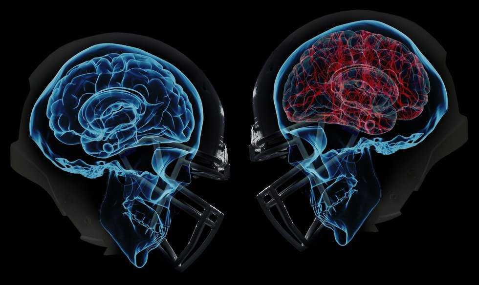 The Downfall Of Contact Sports