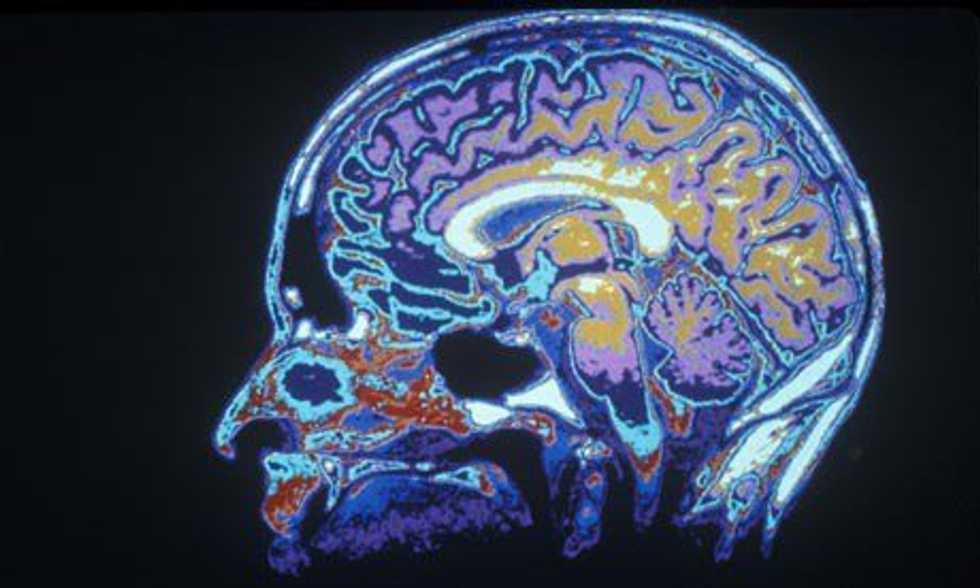 The Concussion: A Deadly Choice