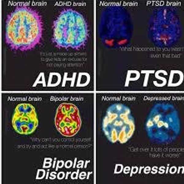 Mental Illness Does Not Define You