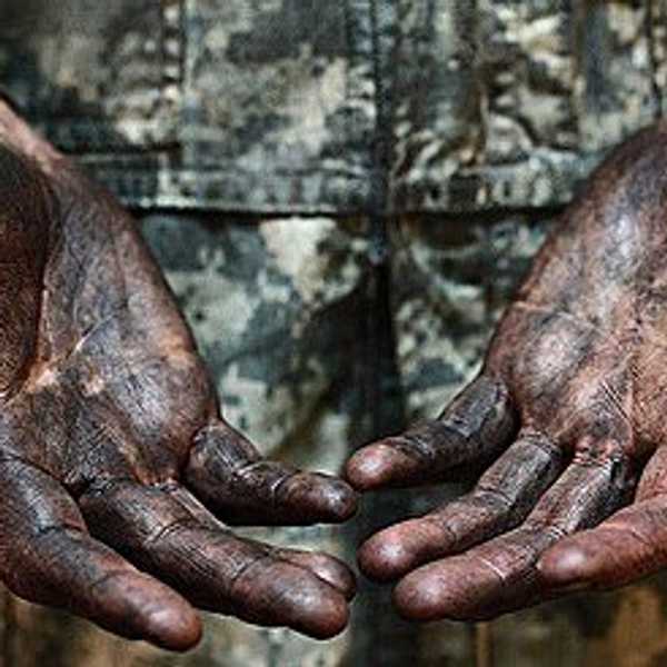 Ugly Hands