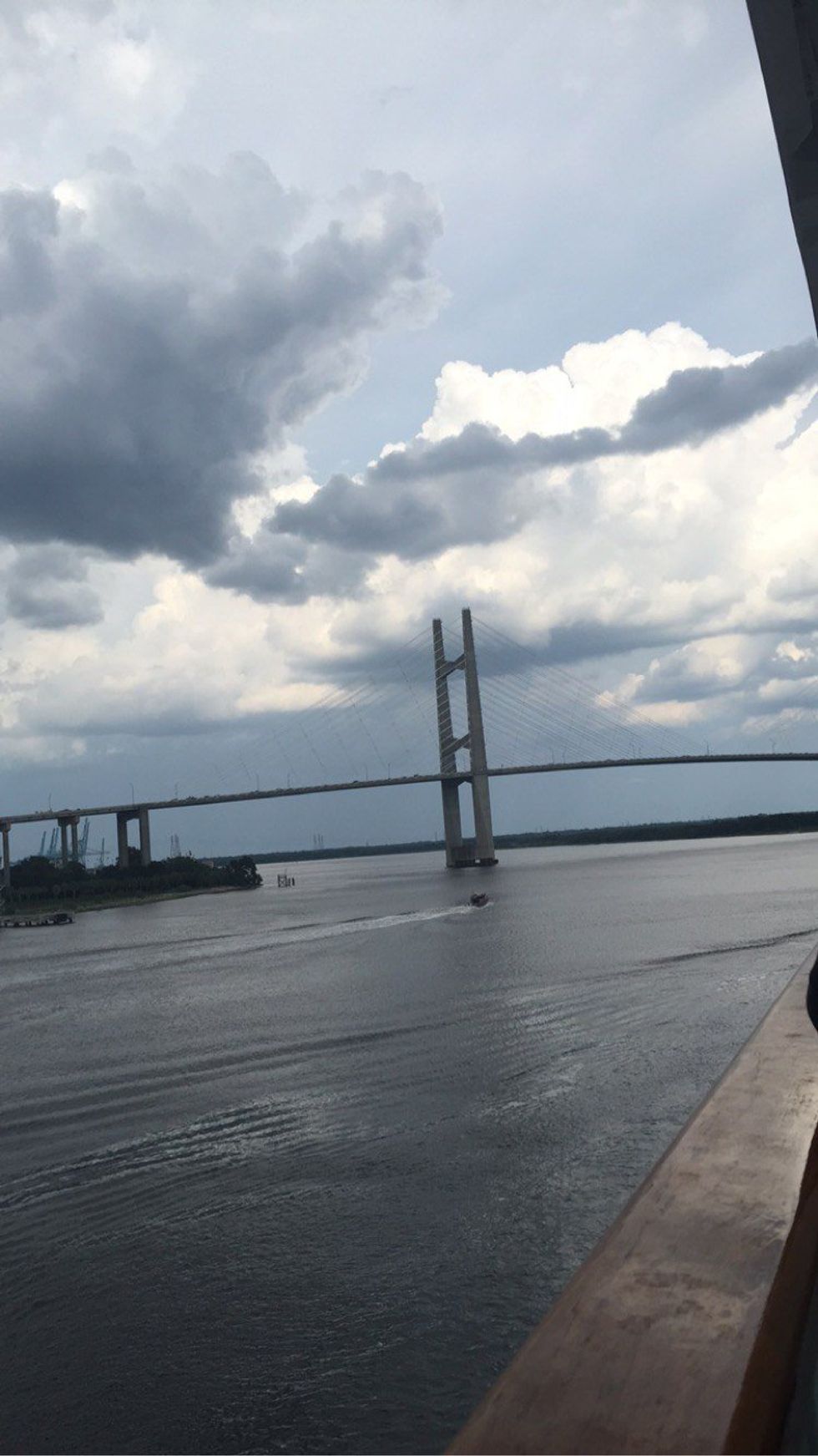 My Birth Defect Can't Stop Me