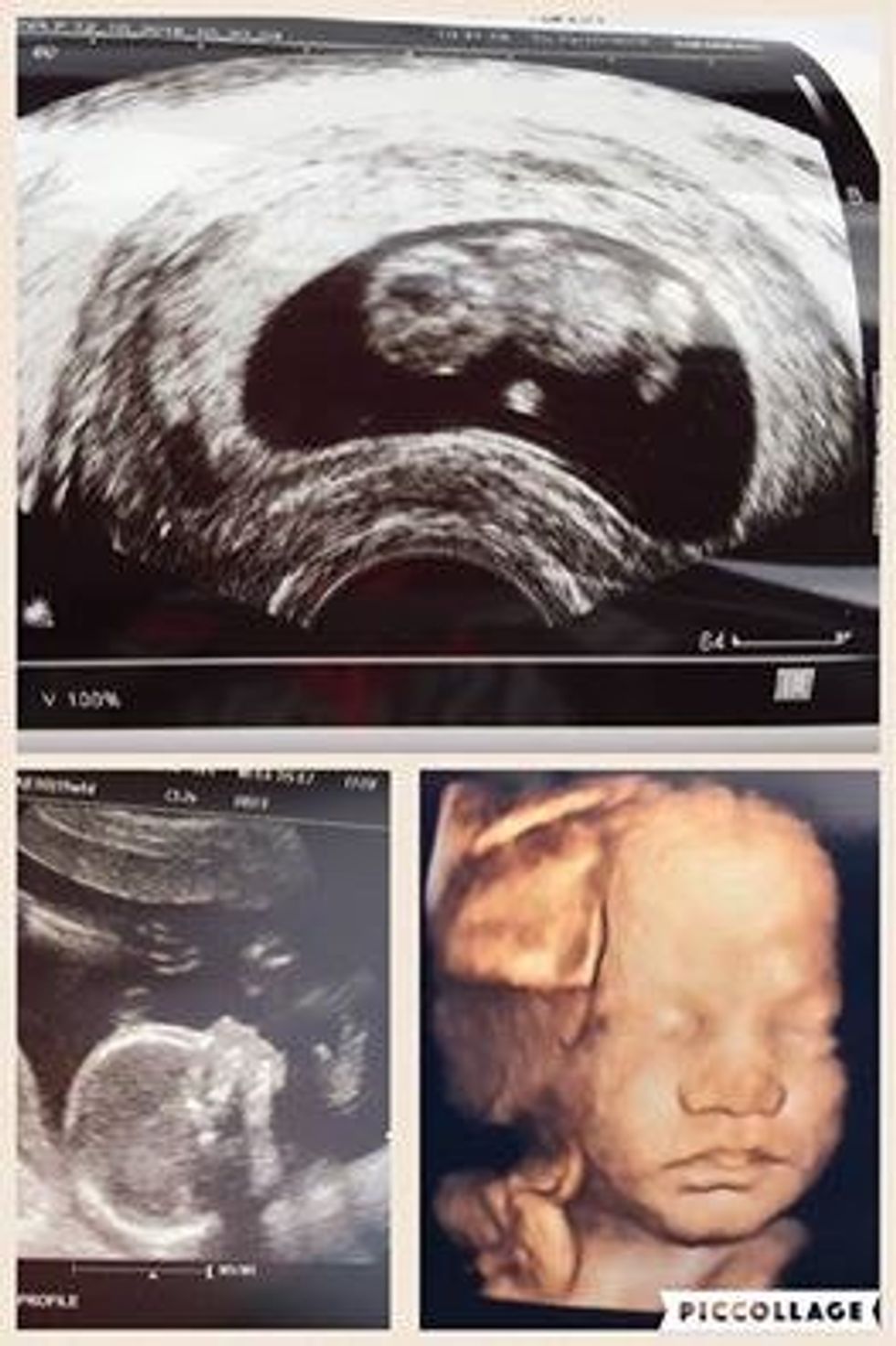 As I Prepare For My Firstborn