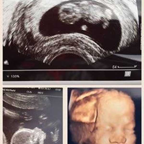 As I Prepare For My Firstborn