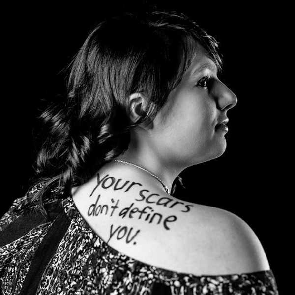 An Open Letter To A Broken Girl