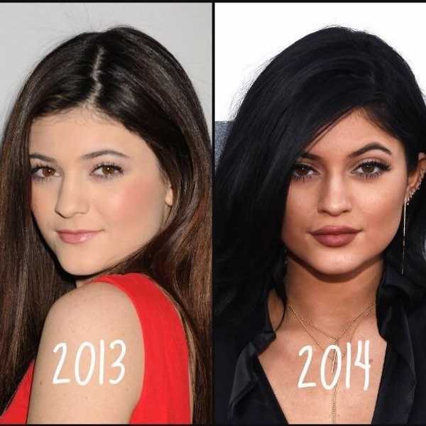 Why Black Features Are Hot But Being Black Is Not